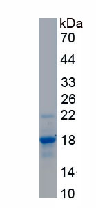 Recombinant Complement Factor P (CFP)