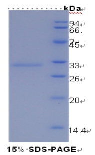 Recombinant Kidney Injury Molecule 1 (Kim1)