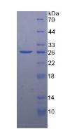 Recombinant Ficolin 1 (FCN1)