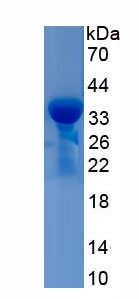 Recombinant Ficolin 1 (FCN1)