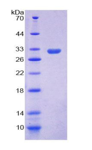 Recombinant Ficolin 1 (FCN1)