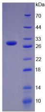 Recombinant Programmed Cell Death Protein 1 Ligand 1 (PDL1)