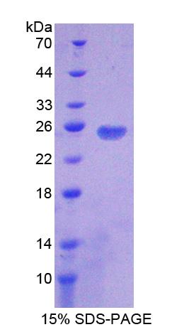 Recombinant Programmed Cell Death Protein 1 Ligand 2 (PDL2)