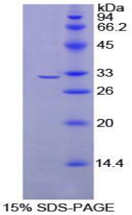 Recombinant Programmed Cell Death Protein 1 Ligand 2 (PDL2)