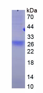 Recombinant Tumor Necrosis Factor Receptor Superfamily, Member 17 (TNFRSF17)