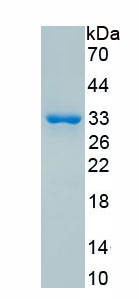 Recombinant Topoisomerase II (TOP2)