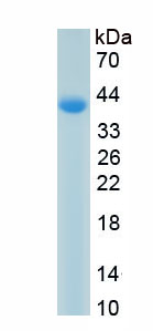 Recombinant Topoisomerase II (TOP2)