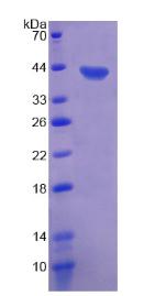 Recombinant Chemokine (C motif) ligand (XCL1)