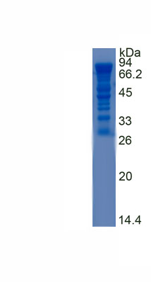 Recombinant Angiotensinogen (AGT)