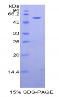 Recombinant Angiotensinogen (AGT)