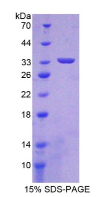 RPA798Hu01.jpg