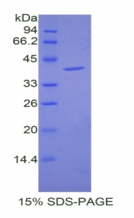 Recombinant Cholecystokinin (CCK)