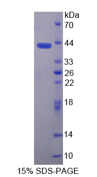 Recombinant Neuromedin B (NMB)