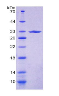 Recombinant Fucosidase Alpha L1, Tissue (FUCa1)