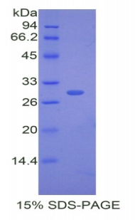 Recombinant Cholesteryl Ester Transfer Protein (CETP)