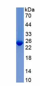 Recombinant Alpha-1-Acid Glycoprotein (a1AGP)