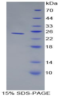 Recombinant Alpha-1-Acid Glycoprotein (a1AGP)