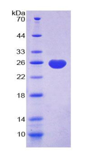 Recombinant Alpha-1-Acid Glycoprotein (a1AGP)