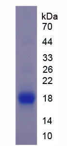 Recombinant Death receptor 5 (DR5)