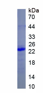 Recombinant Coagulation Factor II (F2)