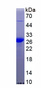 Recombinant C Reactive Protein (CRP)