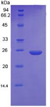 Recombinant C Reactive Protein (CRP)