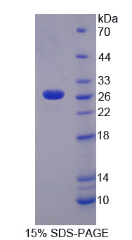 RPA827Hu01.jpg