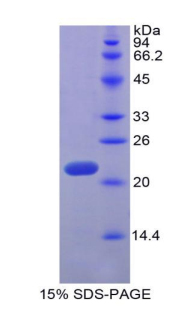 Recombinant Tumor Necrosis Factor Ligand Superfamily, Member 14 (TNFSF14)