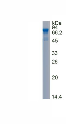 Recombinant Plasmin/Antiplasmin Complex (PAP)