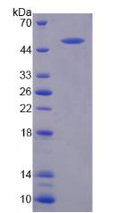 Recombinant Von Willebrand Factor (vWF)