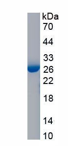 Recombinant Von Willebrand Factor (vWF)