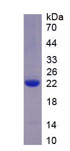 Recombinant Von Willebrand Factor (vWF)