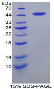 Recombinant Corticotropin Releasing Factor (CRF)