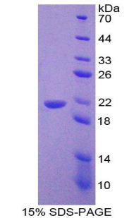 Recombinant Corticotropin Releasing Factor (CRF)