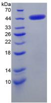 Recombinant Corticotropin Releasing Factor (CRF)