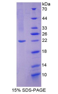 Recombinant Nitric Oxide Synthase 2, Inducible (NOS2)