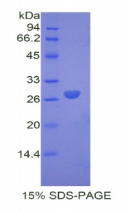 Recombinant Coagulation Factor IX (F9)