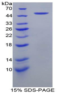 Recombinant Coagulation Factor IX (F9)