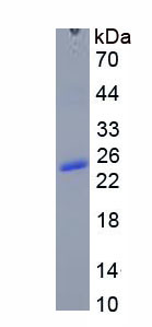 Recombinant Prolactin (PRL)