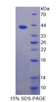 Recombinant Resistin (RETN)