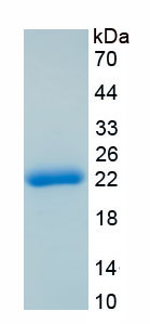 Recombinant Glycogen Phosphorylase, Liver (PYGL)