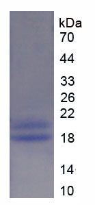 Recombinant Glycogen Phosphorylase, Liver (PYGL)