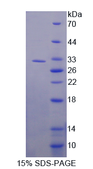 RPA854Hu01.jpg