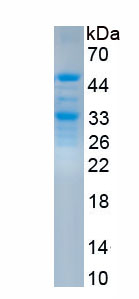 Recombinant Receptor Activator Of Nuclear Factor Kappa B Ligand (RANkL)