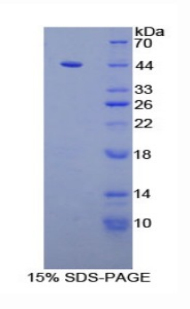 Recombinant Complement Component 3 (C3)