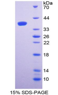 Recombinant Complement Component 3 (C3)