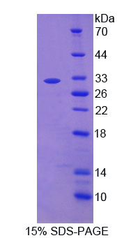 Recombinant Complement Component 2 (C2)