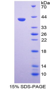 Recombinant Parathyroid Hormone (PTH)