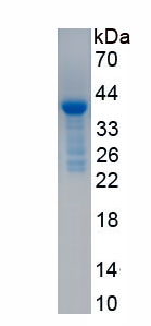 Recombinant Parathyroid Hormone (PTH)