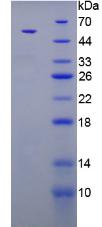 Recombinant Parathyroid Hormone (PTH)